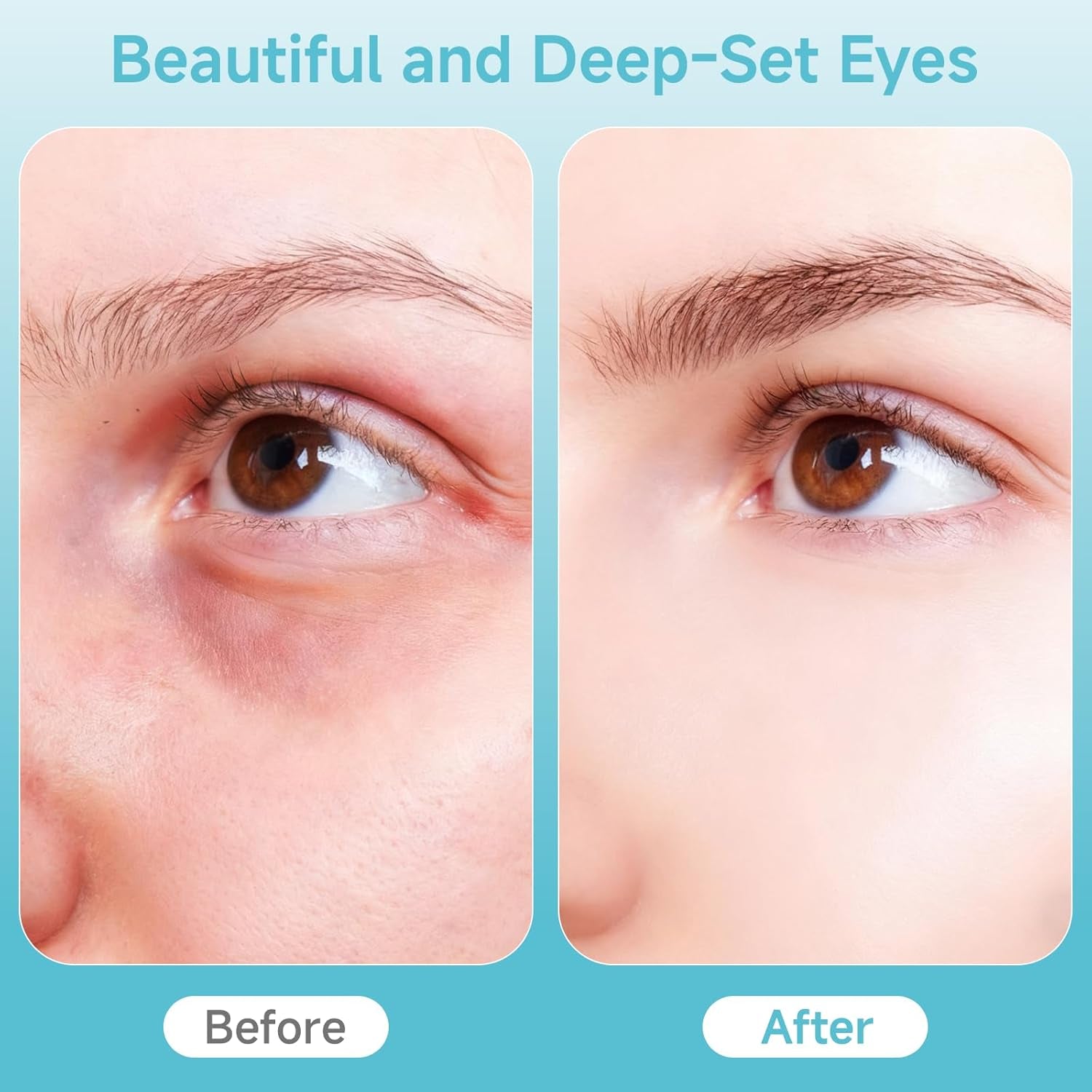 Depuffing Wand for Face & Eyes – 2-In-1 Cold and Heat Facial Therapy with Adjustable Temp