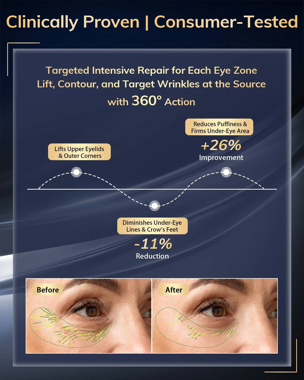 3D Eye Massager 630Nm Red Light Therapy Device for the Treatment of Eye Bags&Dark Circles&Puffiness Periorbital for Treating